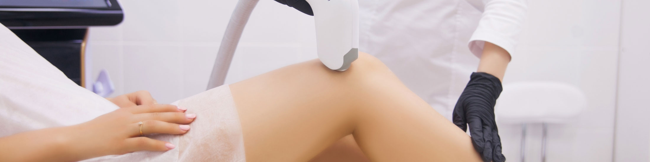 Storitev IPL lasersko odstranjevanje dlak