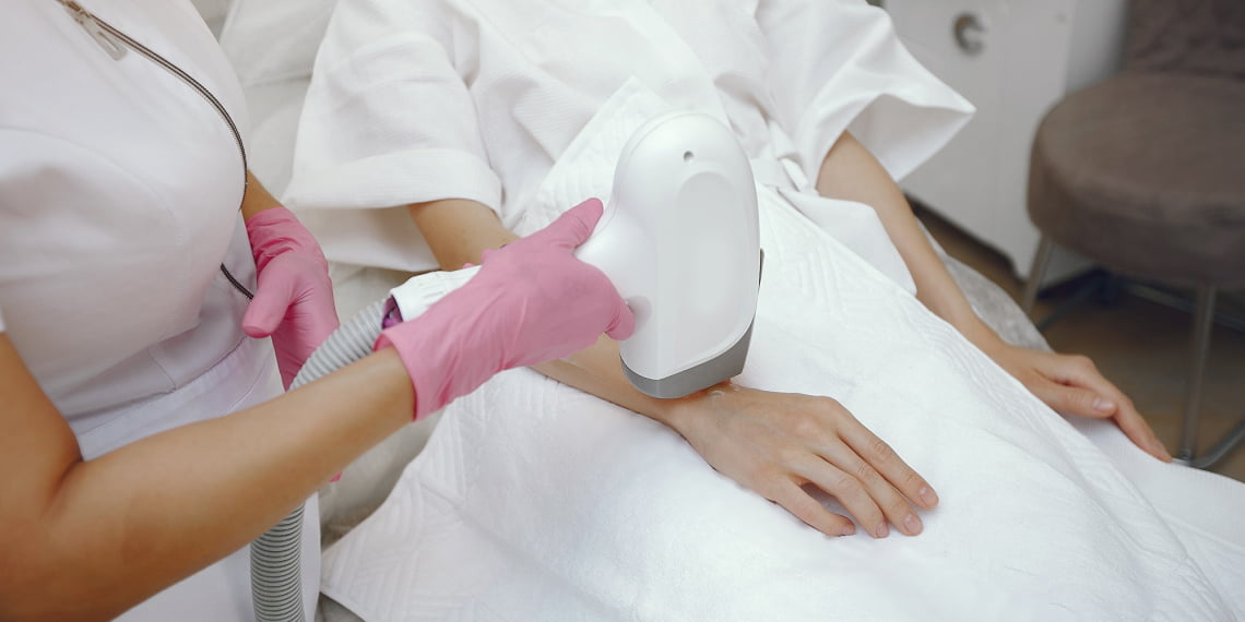 Lasersko odstranjevanje dlak IPL